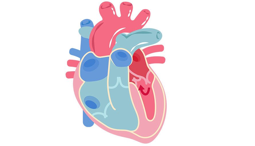 健保大數據40／胸悶、喘不過氣……二尖瓣脫垂要治療嗎？