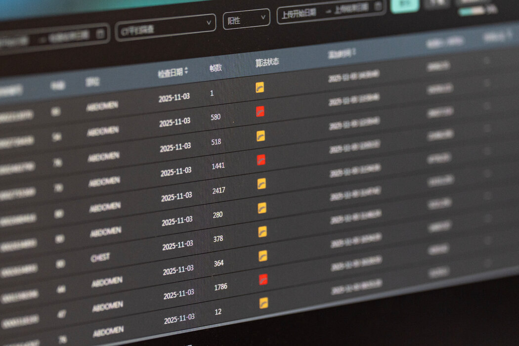 医院老化的硬件难以应付该工具所需的数据处理量,系统有时会在运算过程中崩溃。